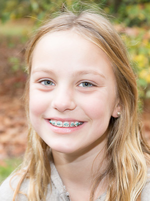 why braces
