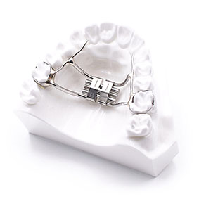 palatal expander