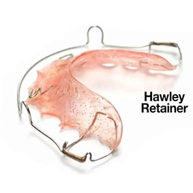 retainers